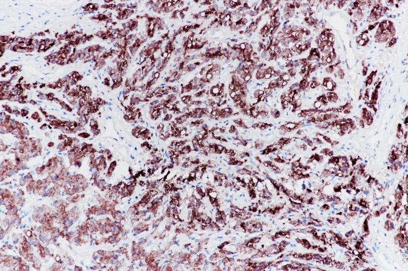 PSA Rabbit Monoclonal Antibody(ARB833)
