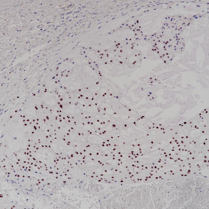 Brachyury Rabbit Monoclonal Antibody(ARB866)
