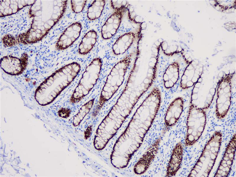 CDX2 Rabbit Monoclonal Antibody(ARB826)