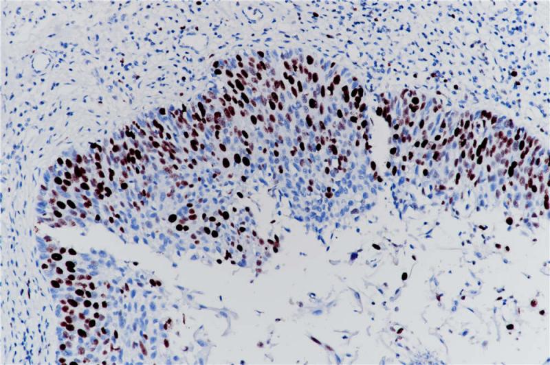 Ki67 Rabbit Monoclonal Antibody(ARB834)