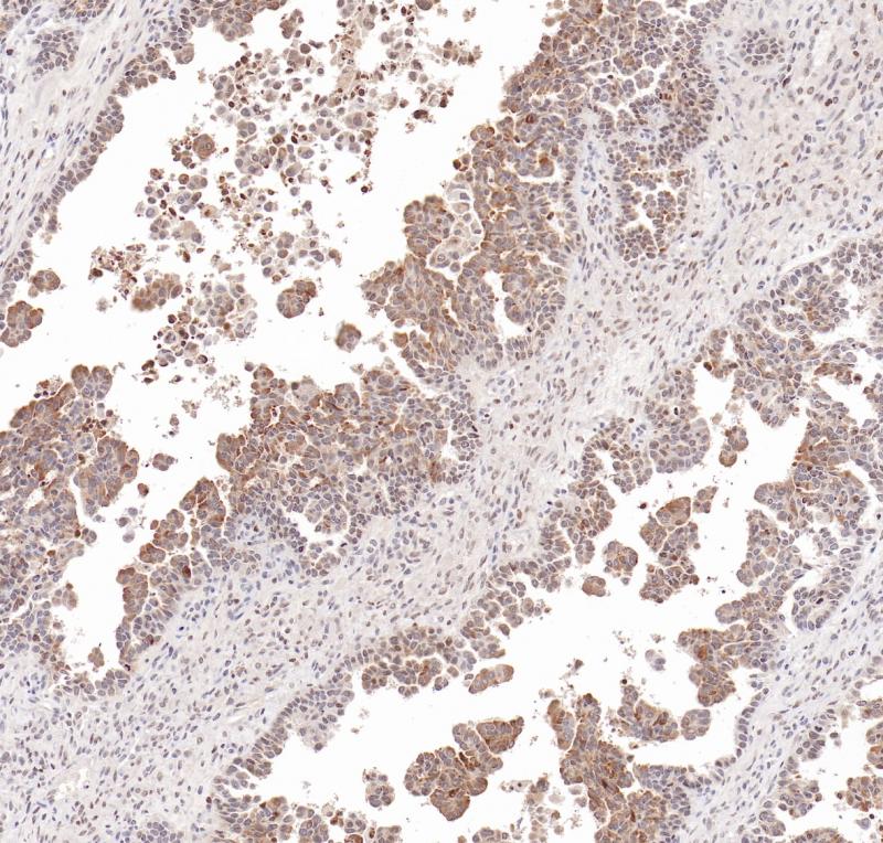 HE4 Rabbit Monoclonal Antibody(ARB863)