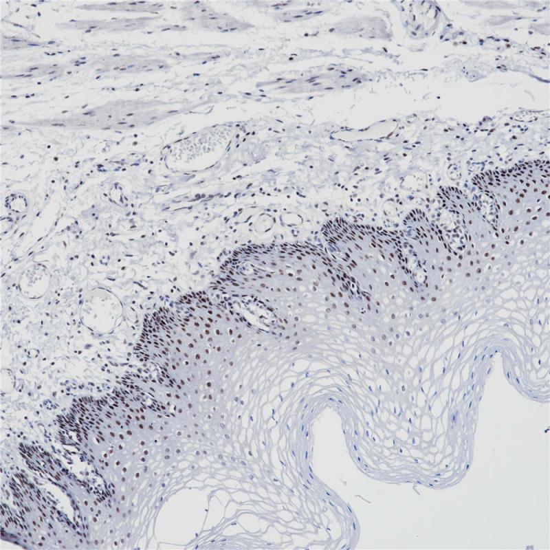 PMS2 Rabbit Monoclonal Antibody(ARB844)
