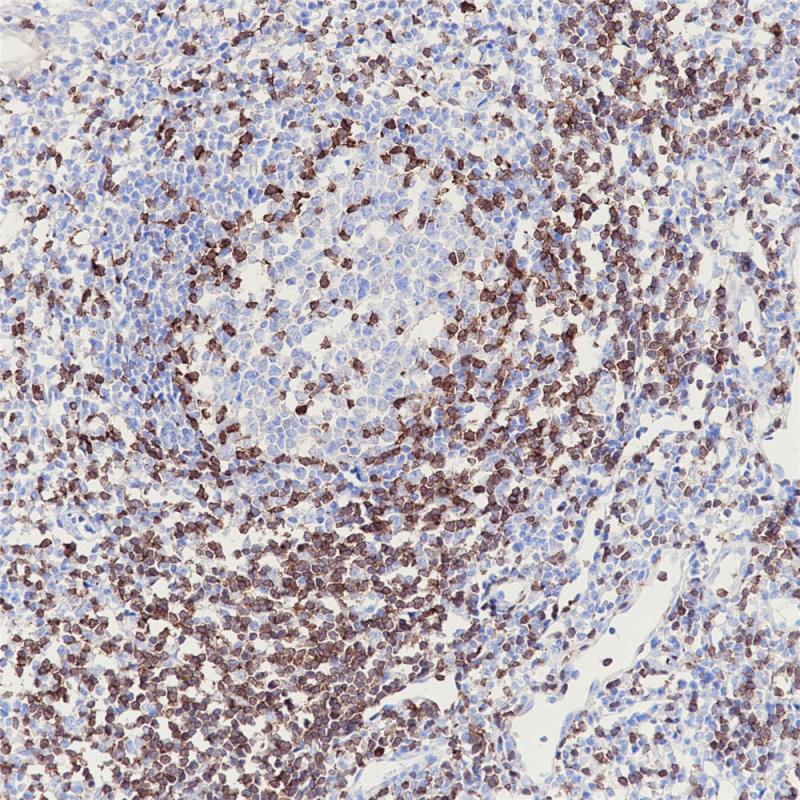 ZAP-70 Rabbit Monoclonal Antibody(ARB859)