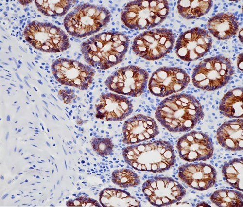 CDH17 Rabbit Monoclonal Antibody(ARB917)