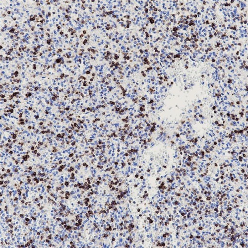 CD7 Rabbit Monoclonal Antibody(ARB913)