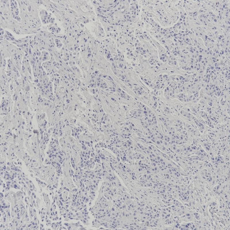 ER Rabbit Monoclonal Antibody(ARB845)