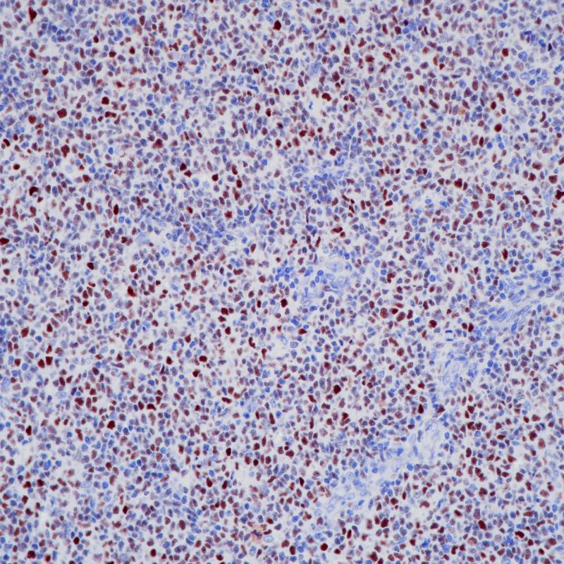 Bcl-6 Rabbit Monoclonal Antibody(ARB879)