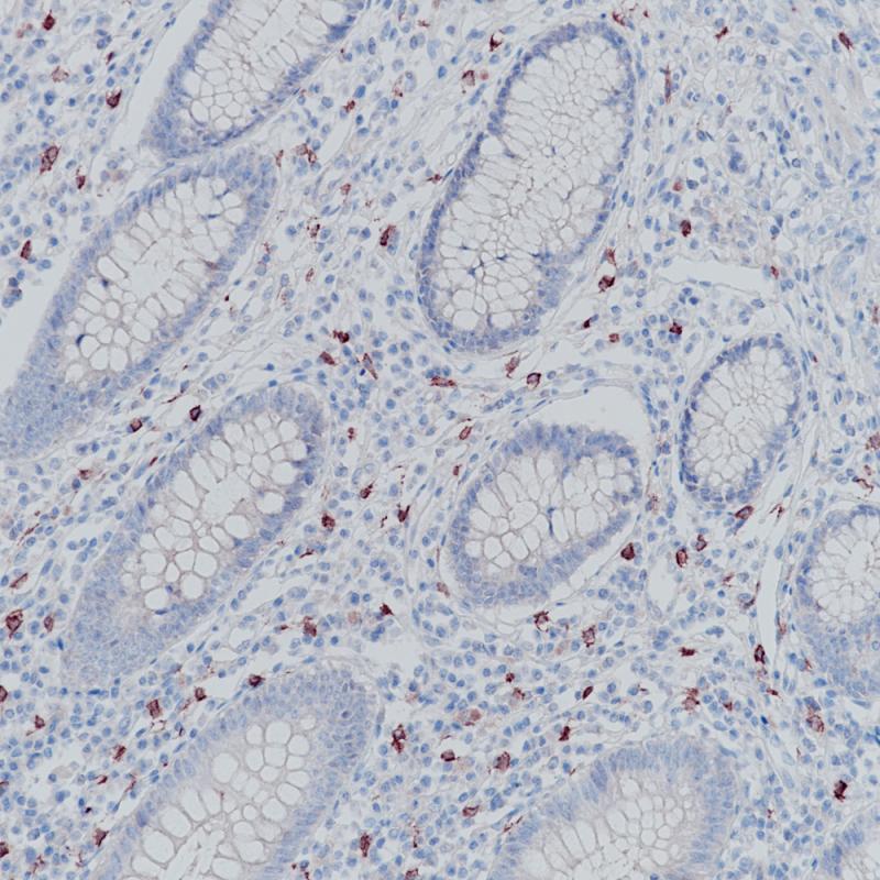 CD117 Rabbit Monoclonal Antibody(ARB837)