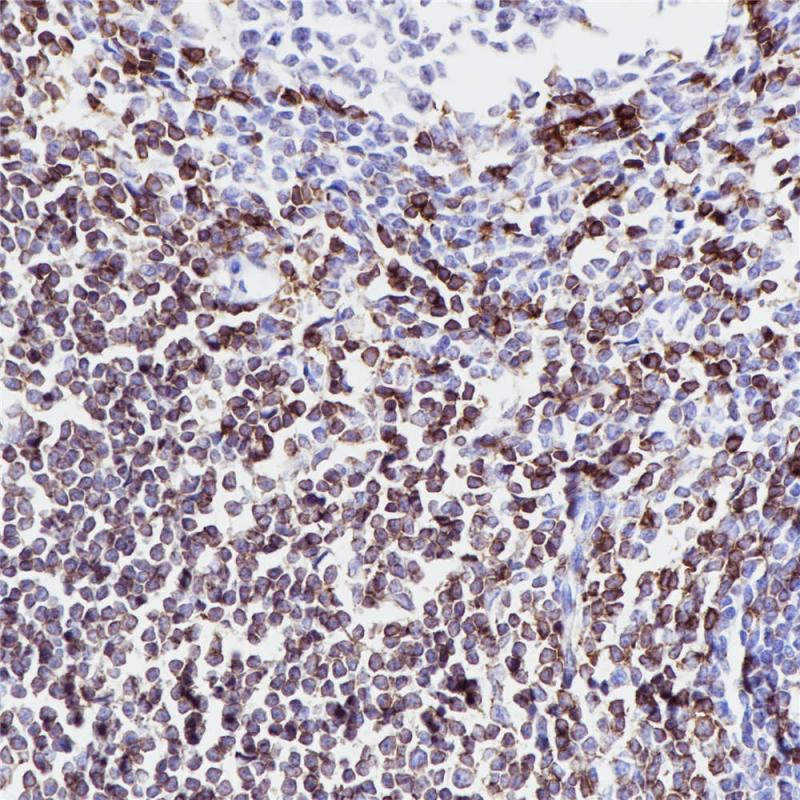 CD5 Rabbit Monoclonal Antibody(ARB842)