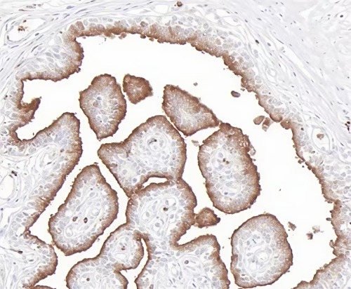 CD63 Rabbit Monoclonal Antibody(ARB912)