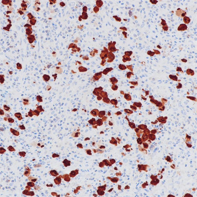 ALK Rabbit Monoclonal Antibody(ARB870)