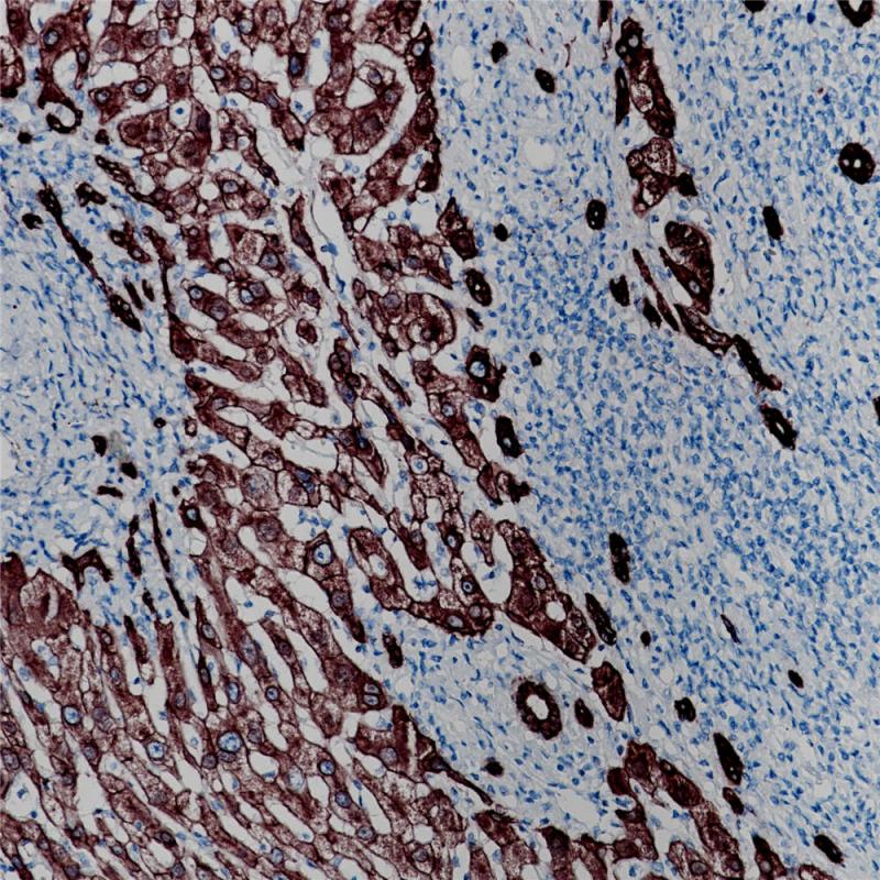 Cytokeratin 18 Rabbit Monoclonal Antibody(ARB856)