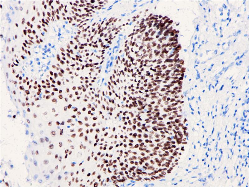p40 Rabbit Monoclonal Antibody(ARB829)