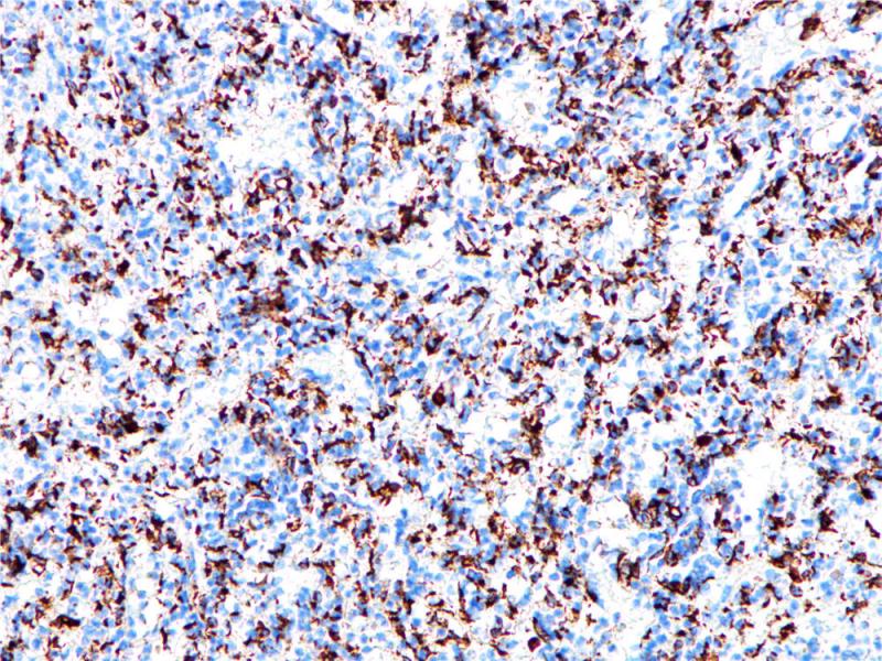 CD68 Rabbit Monoclonal Antibody(ARB830)