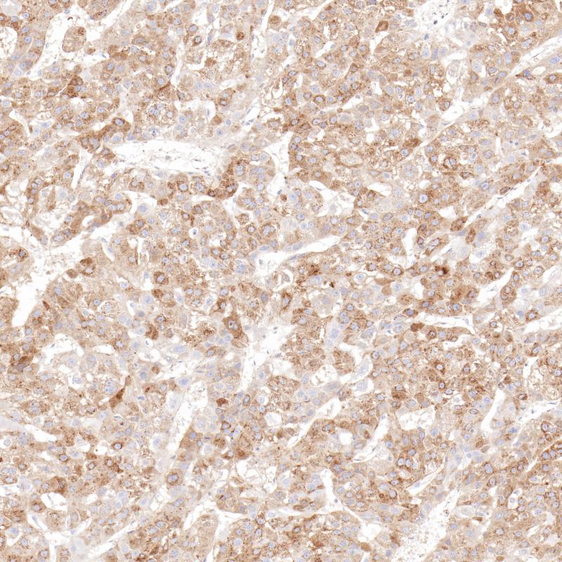 AFP Rabbit Monoclonal Antibody(ARB869)