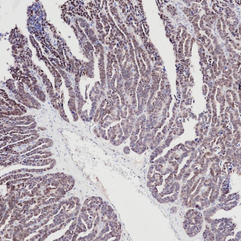 PAX8 Rabbit Monoclonal Antibody(ARB846)