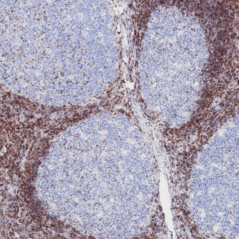 Bcl-2 Mouse Monoclonal Antibody(ARB878)