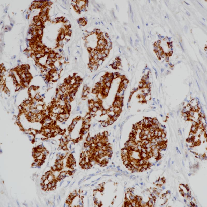 AMACR Mouse Monoclonal Antibody(ARB872)