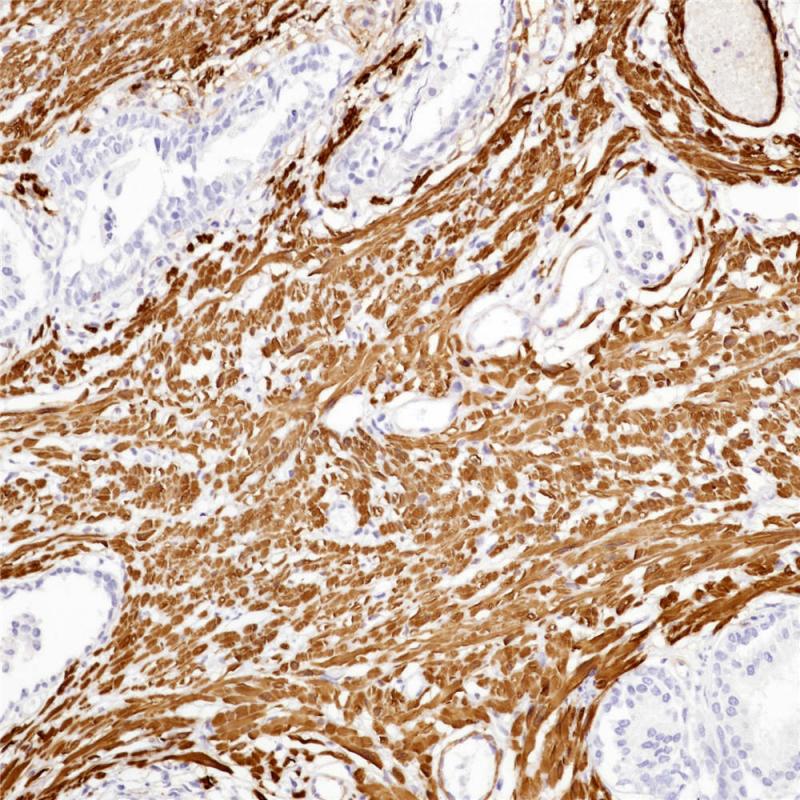 SMH Rabbit Monoclonal Antibody(ARB843)