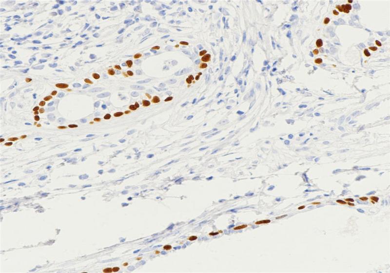 p63 Rabbit Monoclonal Antibody(ARB831)