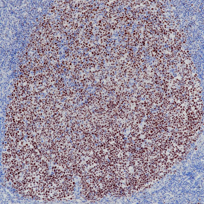 Bcl-6 Rabbit Monoclonal Antibody(ARB880)