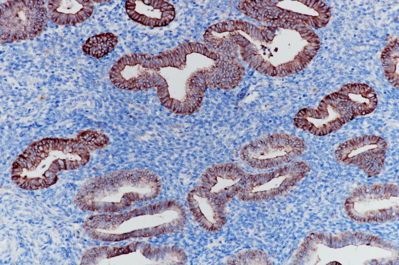 Type I Cytokeratins Rabbit Monoclonal Antibody(ARB857)