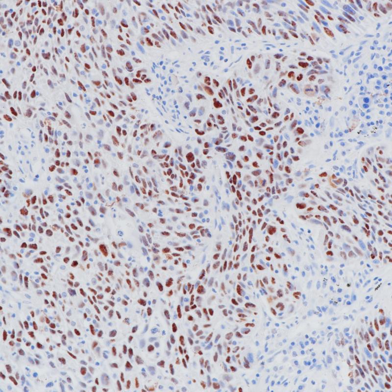 p53 Mouse Monoclonal Antibody(ARB851)