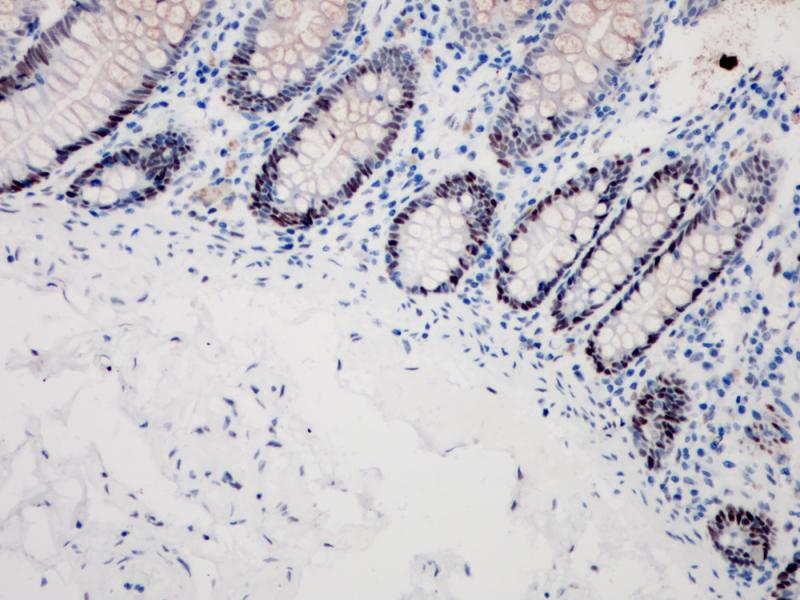 MSH6 Rabbit Monoclonal Antibody(ARB825)