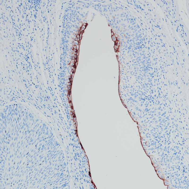 Uroplakin III Rabbit Monoclonal Antibody(ARB865)
