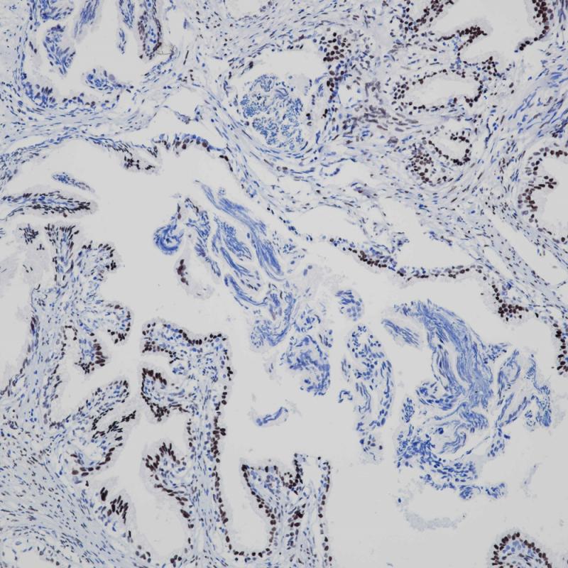 Androgen Receptor Rabbit Monoclonal Antibody(ARB873)