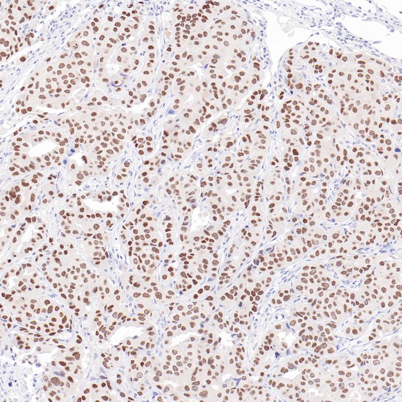 TRPS1 Rabbit Monoclonal Antibody(ARB847)
