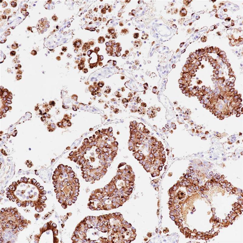 Napsin A Rabbit Monoclonal Antibody(ARB840)