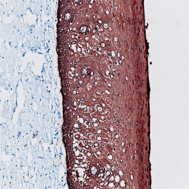 Type II Cytokeratins Rabbit Monoclonal Antibody(ARB858)