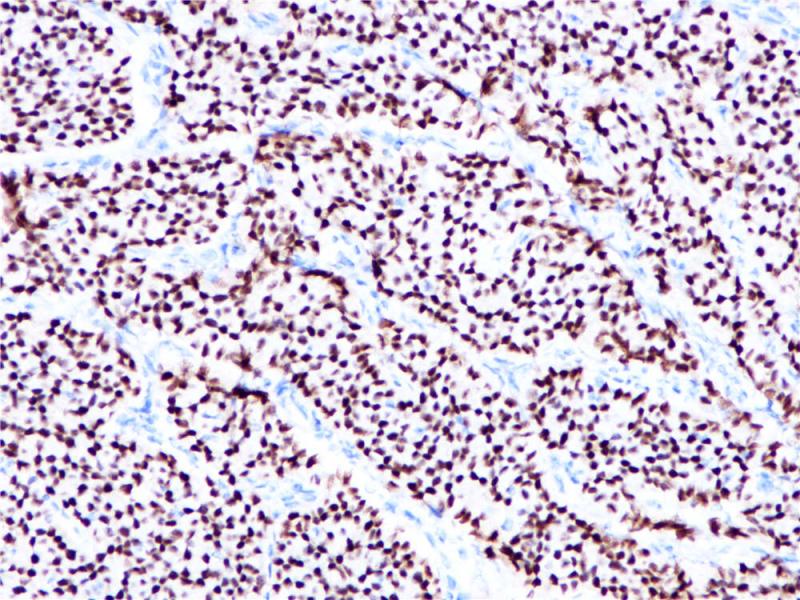ER Rabbit Monoclonal Antibody(ARB828)