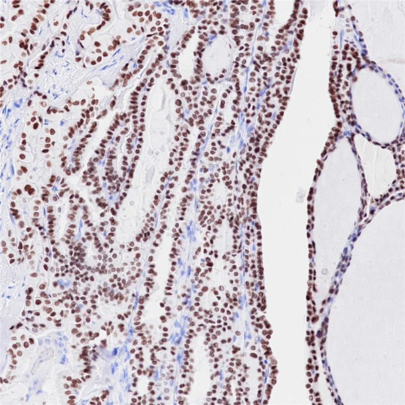 TTF1 Rabbit Monoclonal Antibody(ARB839)