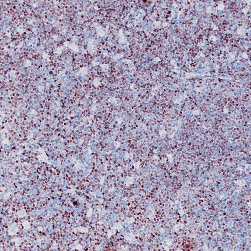 SOX-11 Rabbit Monoclonal Antibody(ARB862)