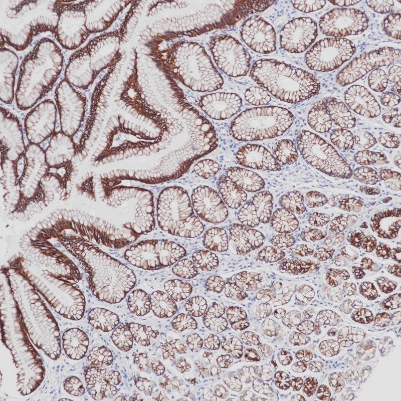 CK-PAN Rabbit Monoclonal Antibody Cocktail(ARB857/ARB858)