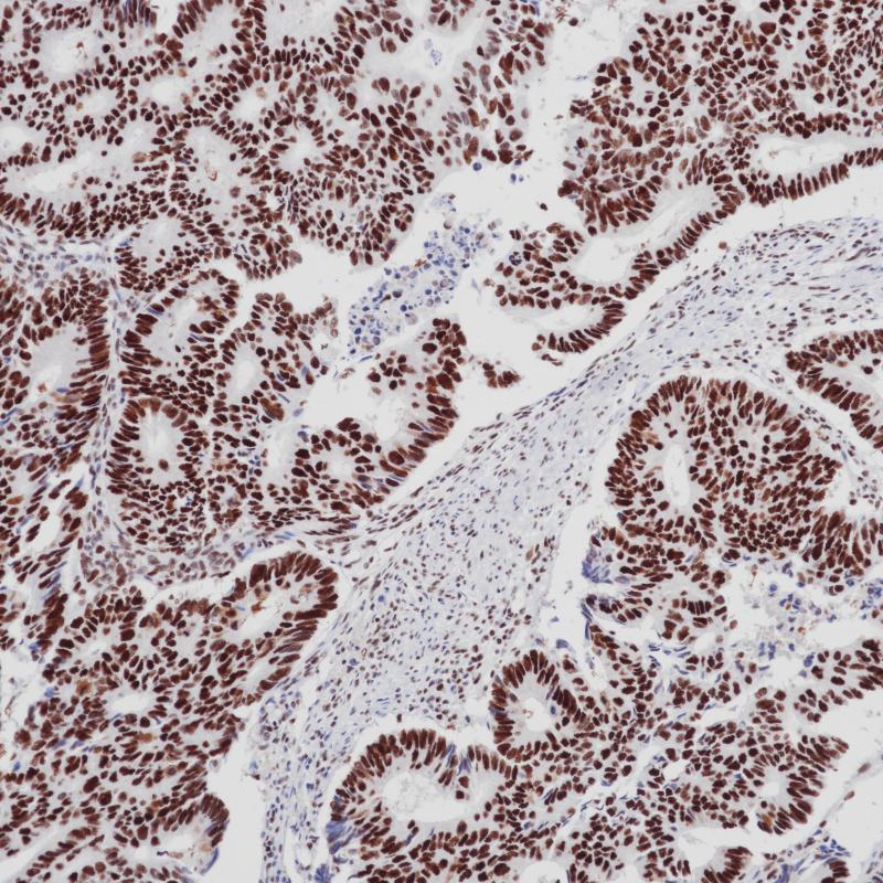MSH2 Mouse Monoclonal Antibody(ARB849)