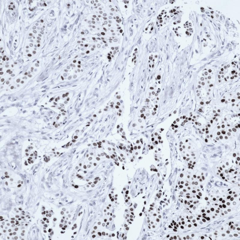 PR Rabbit Monoclonal Antibody(ARB821)
