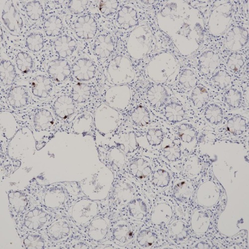 Chromogranin A Rabbit Monoclonal Antibody(ARB920)