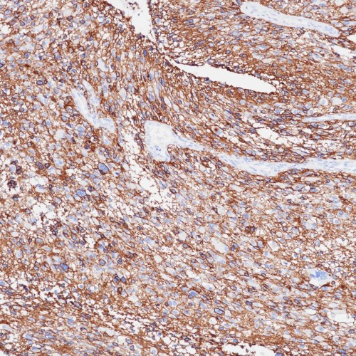 CD56 Rabbit Monoclonal Antibody(ARB911)