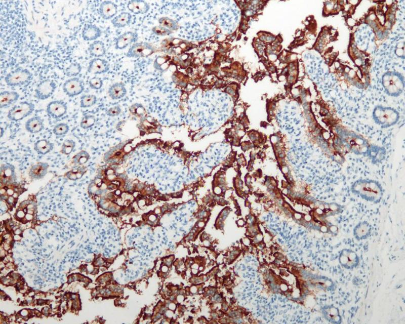 ACE2 Rabbit Monoclonal Antibody(ARB867)