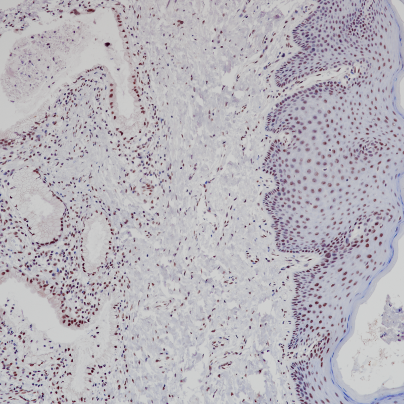 ATRX Rabbit Monoclonal Antibody(ARB876)