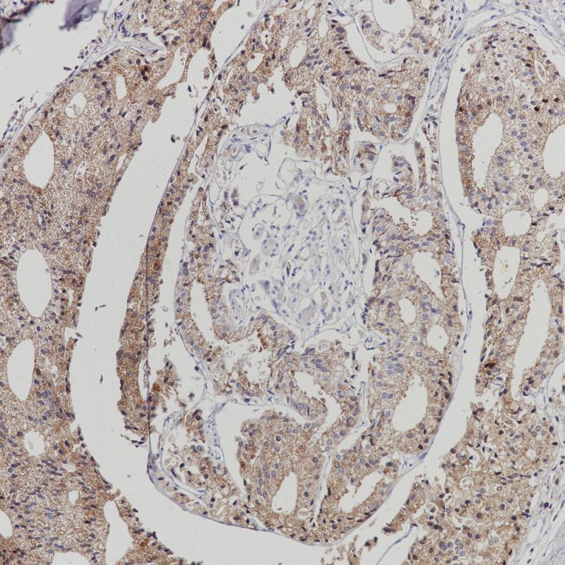 AMACR Rabbit Monoclonal Antibody(ARB871)