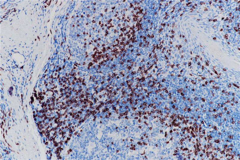 CD3 Rabbit Monoclonal Antibody(ARB832)