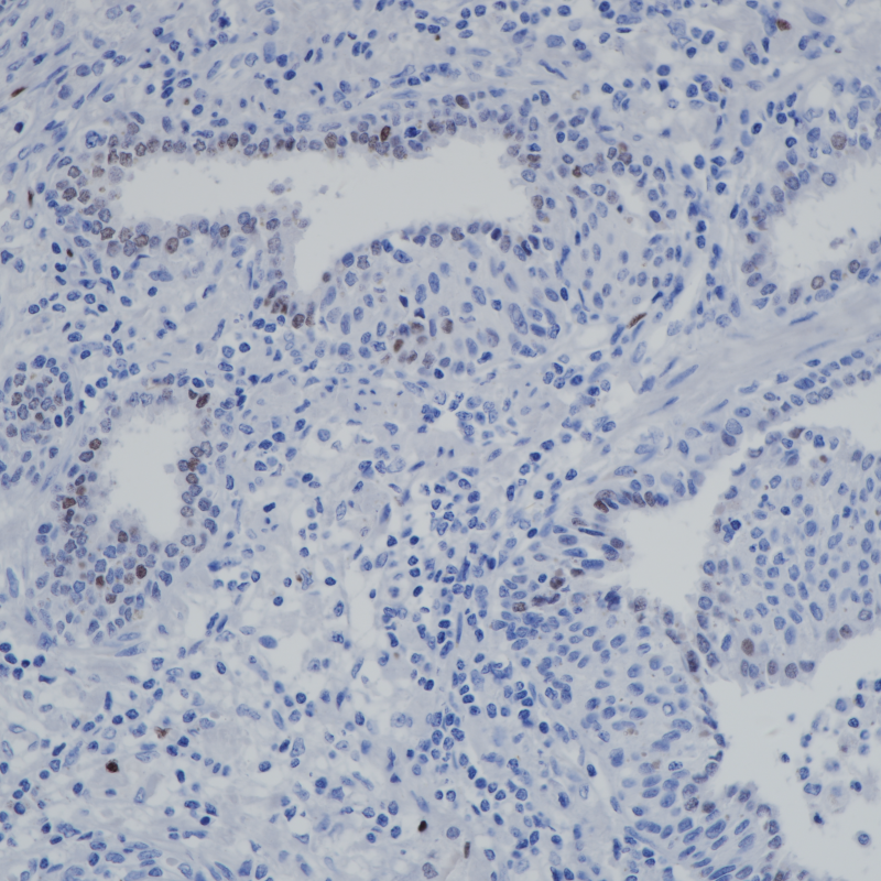 AR-V7 Rabbit Monoclonal Antibody(ARB875)
