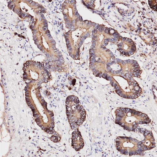 CEA Rabbit Monoclonal Antibody(ARB919)