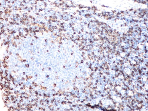 CD4 Rabbit Monoclonal Antibody(ARB909)