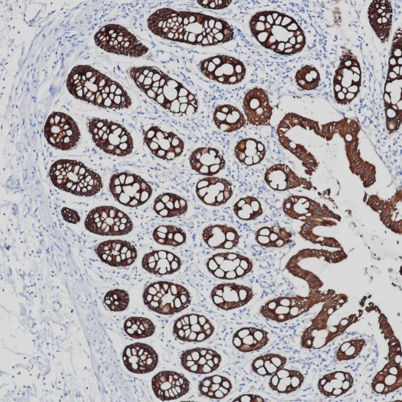 CK8/18 Rabbit Monoclonal Antibody Cocktail(ARB855/ARB856)