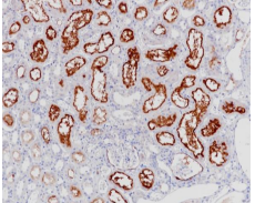 MDR-1 Rabbit Monoclonal Antibody(ARB986)